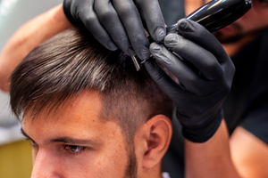 Hair loss treatment